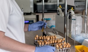 Kontrowersyjna ustawa o medycynie laboratoryjnej?
