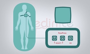 Medinice zawiera umowę ramową na przeprowadzenie badań klinicznych w projekcie PacePress