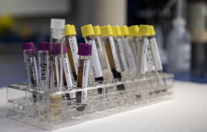 Biomed wyprodukował immunoglobulinę z osocza