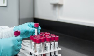 Mastocytoza – przy diagnozie kluczowa jest znajomość objawów