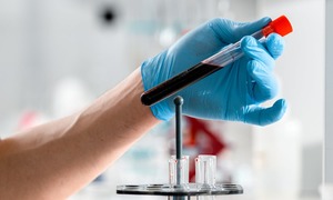 EMA pozytywnie zaopiniowała i zaakceptowała plan badań klinicznych PolTREG  w ramach terapi